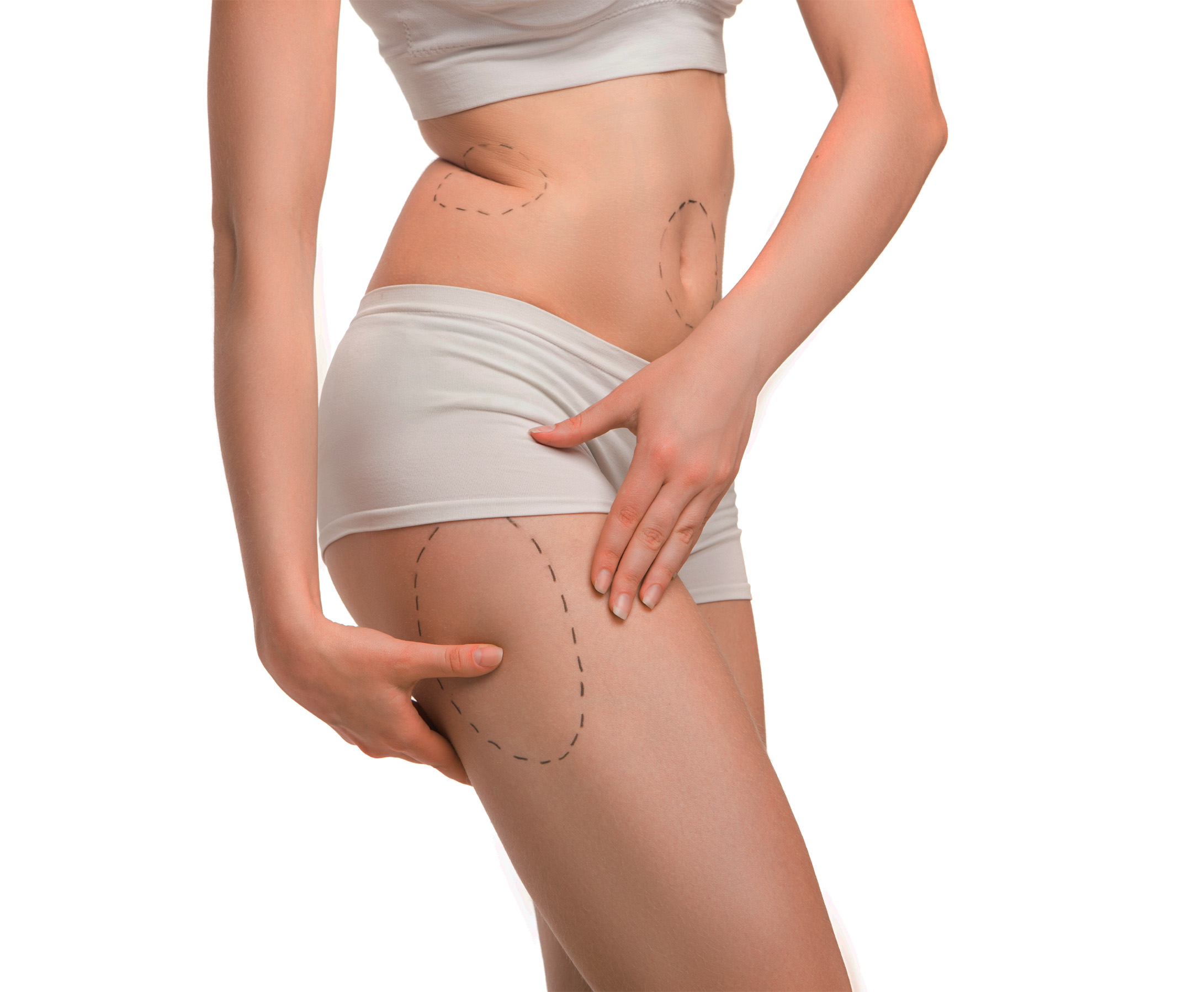 Thigh Tuck Treatment